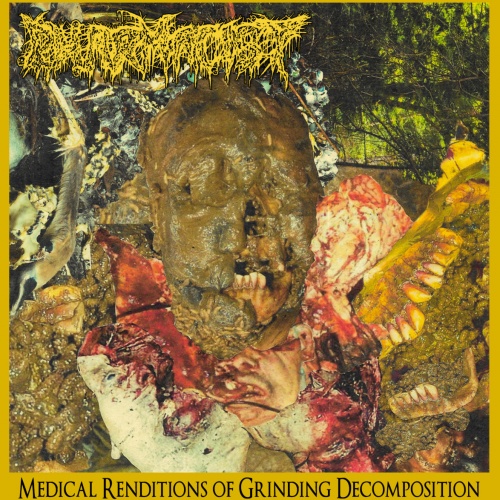 Pharmacist - Medical Renditions of Grinding Decomposition (2020)